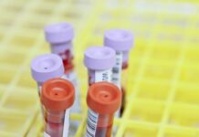 WADA sends athlete engagement and observer teams to Asian Games 2026 in Nagoya Sample tubes in a laboratory rack, representative image for WADA anti-doping testing story