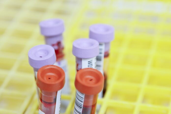 Sample tubes in a testing laboratory Sample tubes in a laboratory rack, representative image for WADA anti-doping testing story